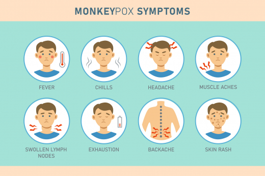 Monkeypox Virus Symptoms Infographics With Icons.